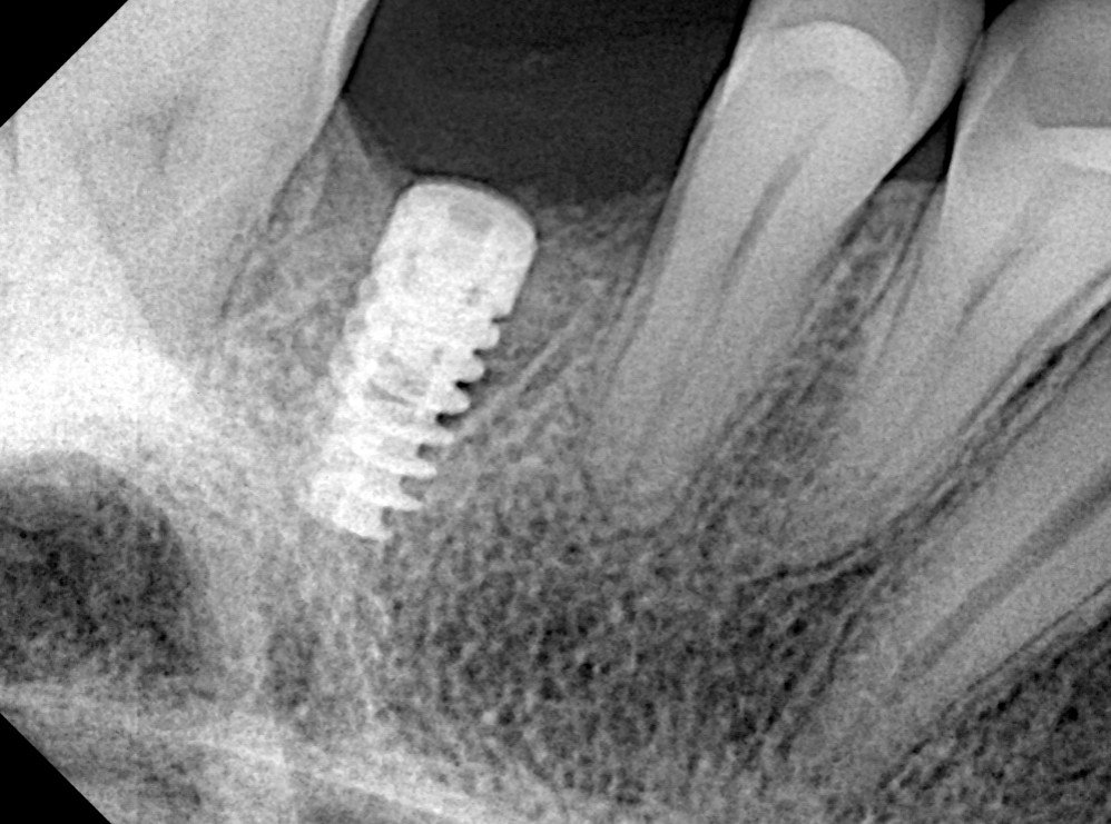 Odontología digital 20241025 193908