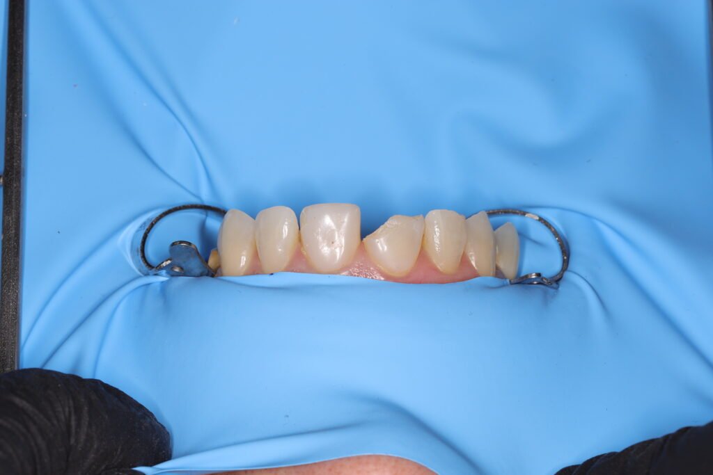 Odontología restauradora img 7043