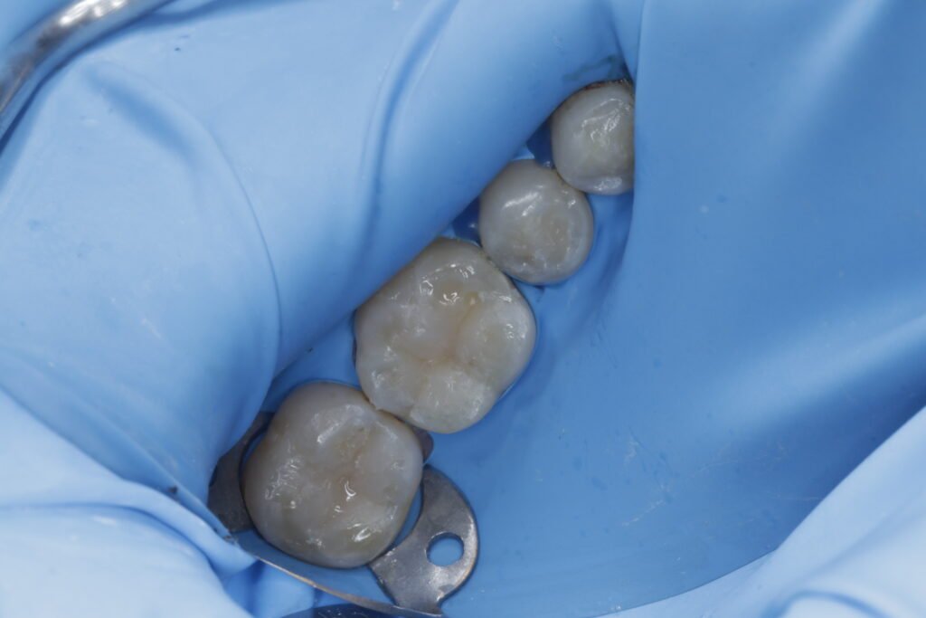 Odontología restauradora mg 4691
