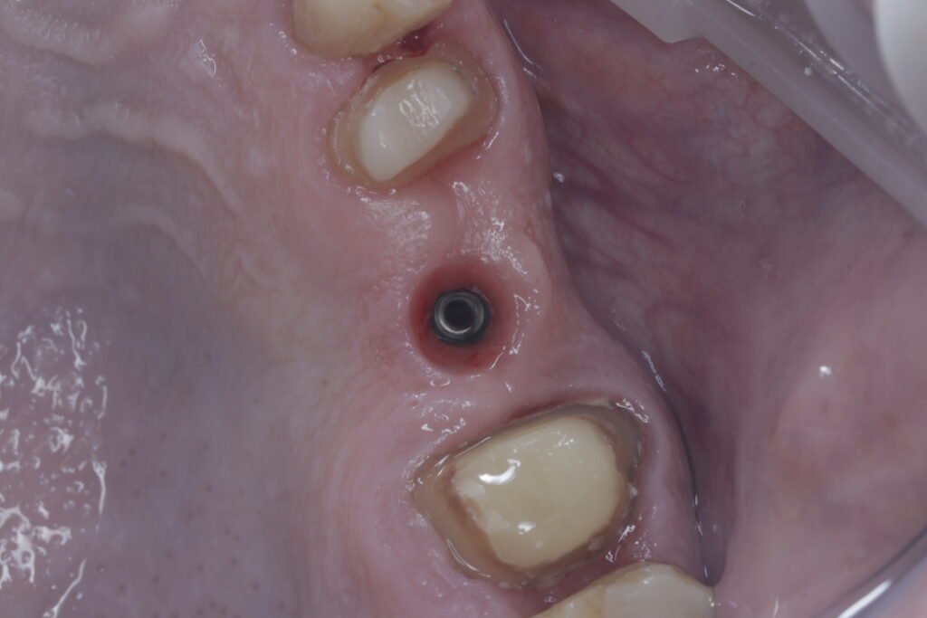 Odontología restauradora mg 5519