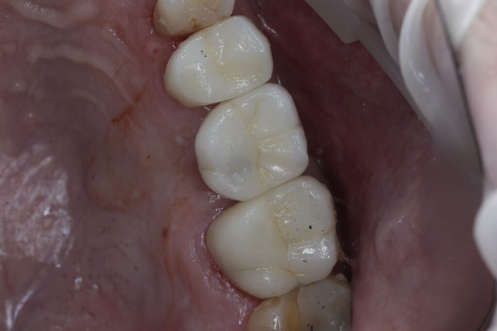 Odontología restauradora mg 5526