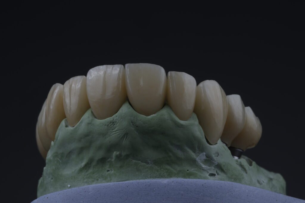 Odontología restauradora mg 5605