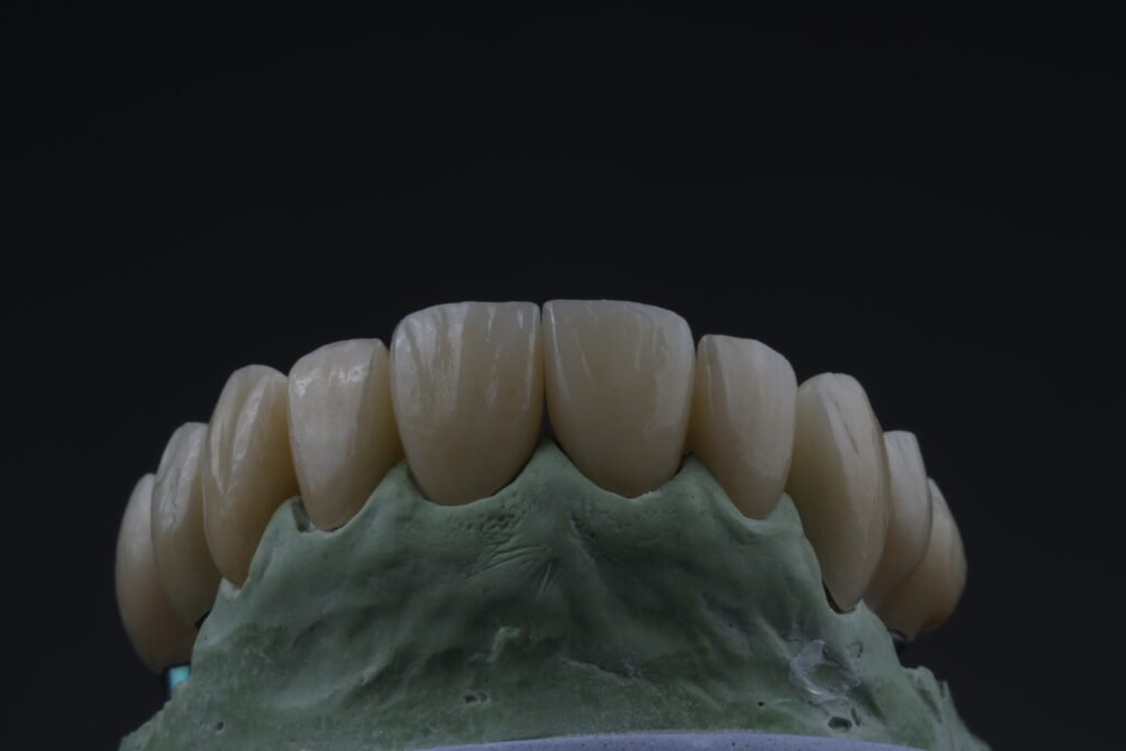 Odontología restauradora mg 5606