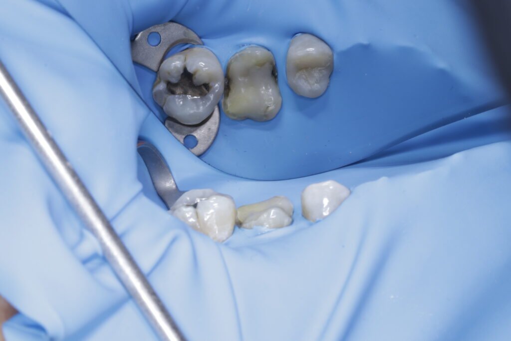 Odontología restauradora mg 9833