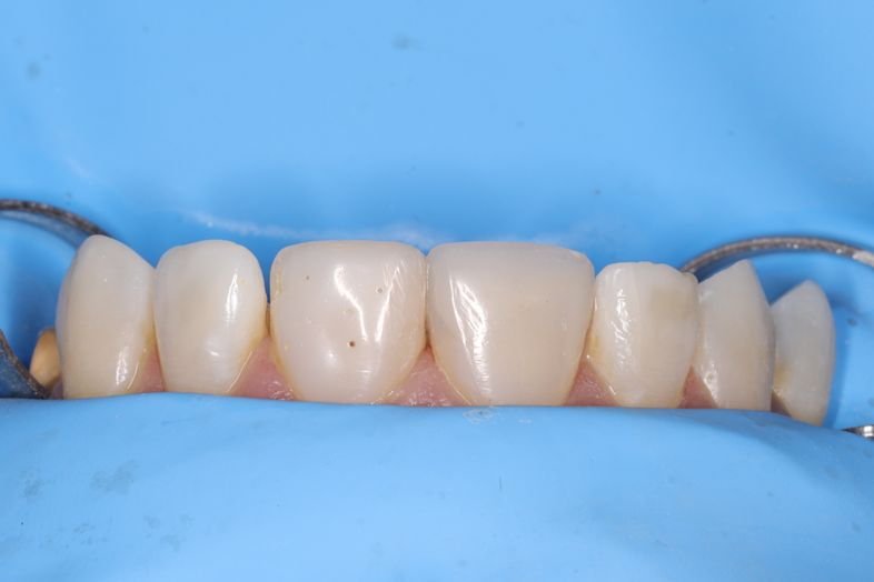 Odontología restauradora b37c1233 3a34 406a ba1d 8186612d8d39